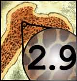 bonemarrow29.jpg