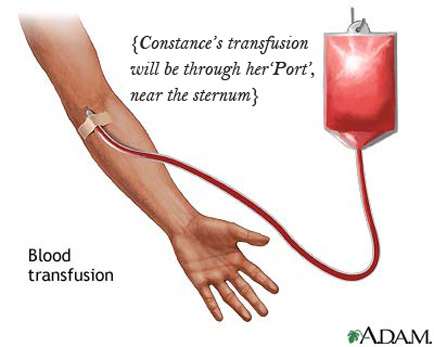 transfusion_with_note