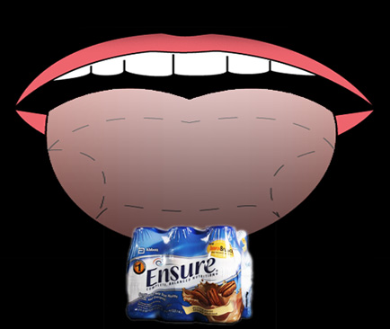 ensure_tongue